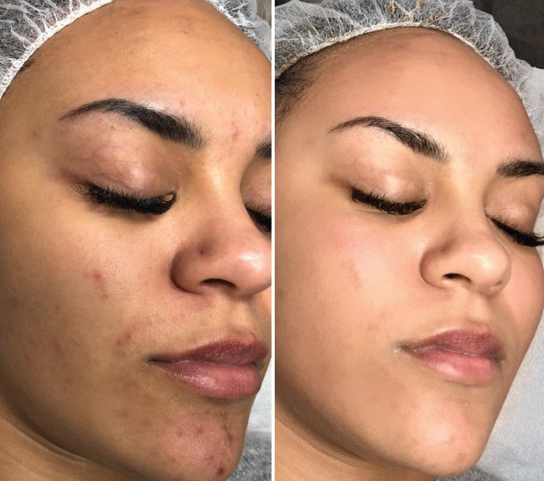 STAYVE - SÉRUM TEINTÉE N°4 - BB  GLOW