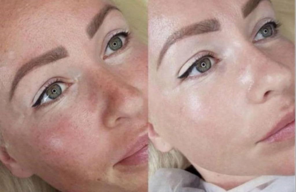 STAYVE - SÉRUM TEINTÉE N°1 - BB GLOW