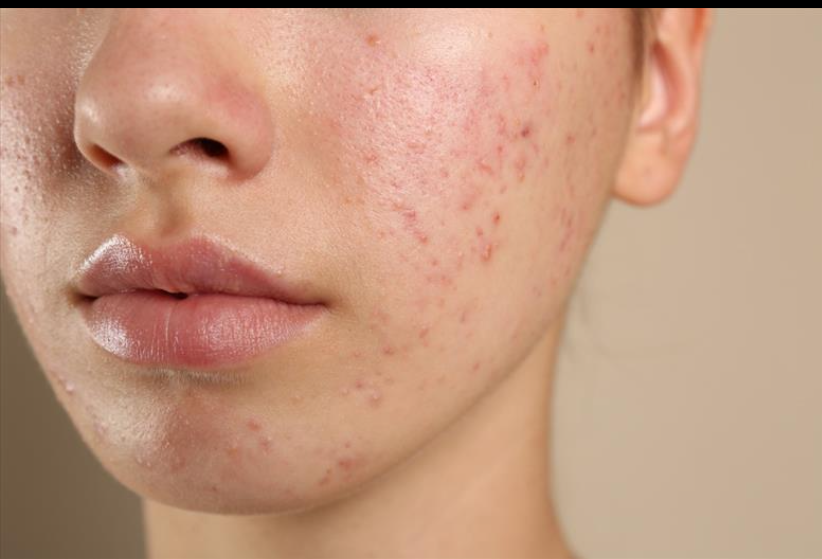 STAYVE - SÉRUM AC STEM GOLD