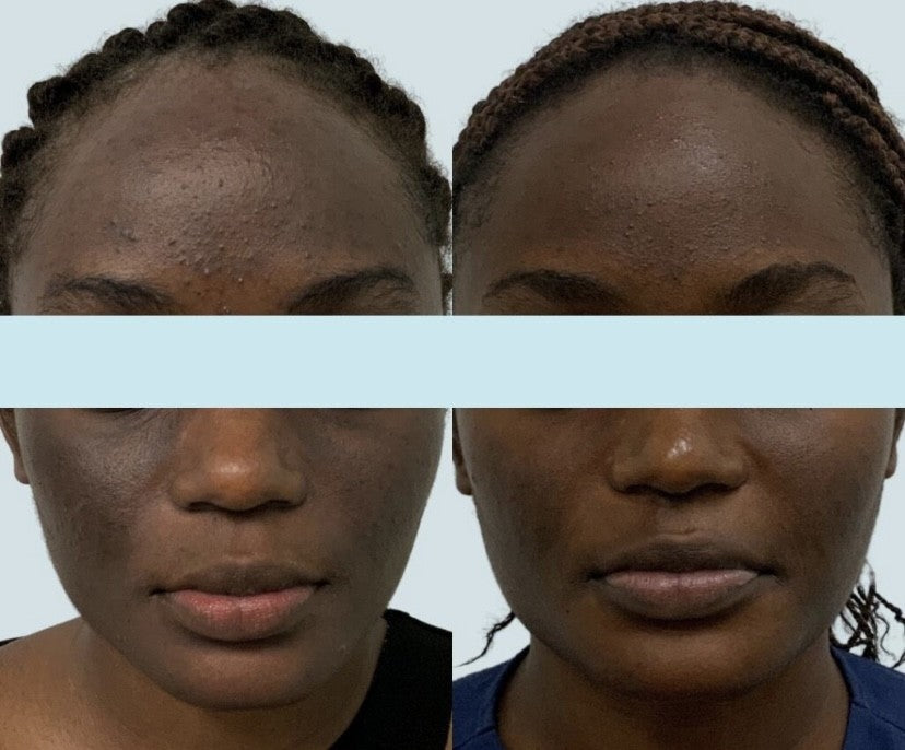 STAYVE - SÉRUM AC STEM GOLD