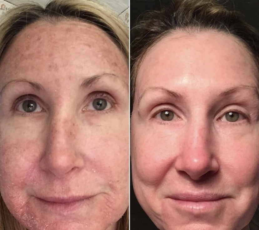 STAYVE - SÉRUM AC STEM GOLD