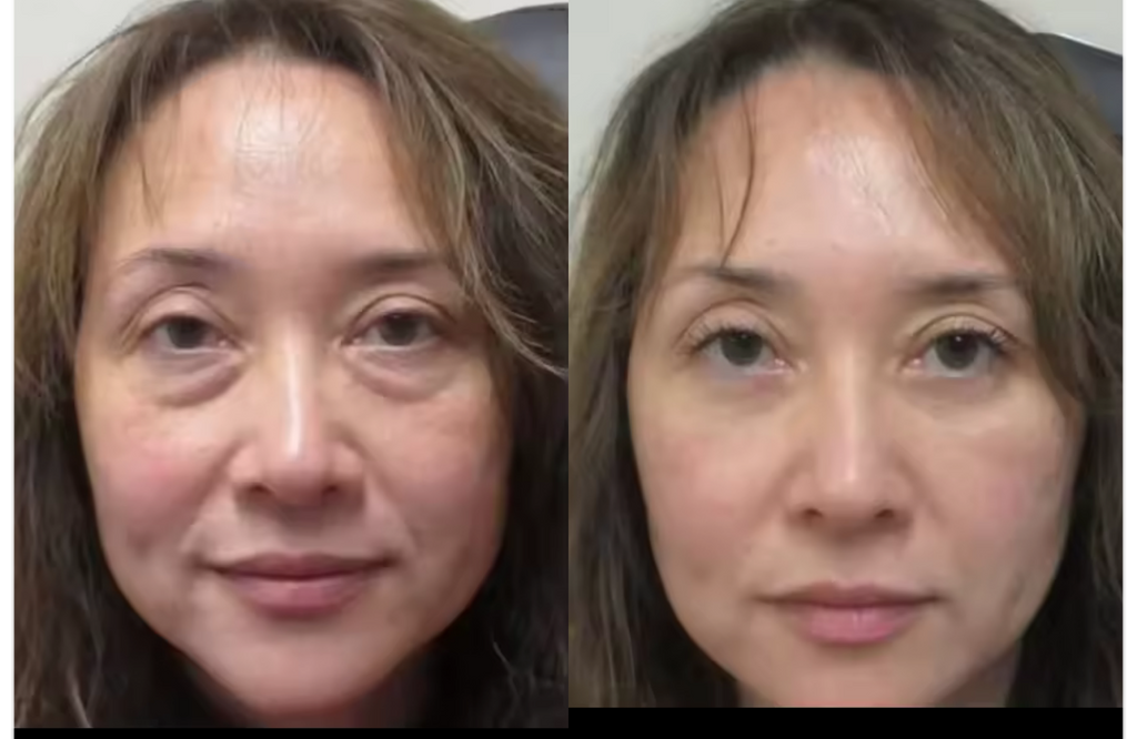 STAYVE - SÉRUM HYALURONIC ACID +++