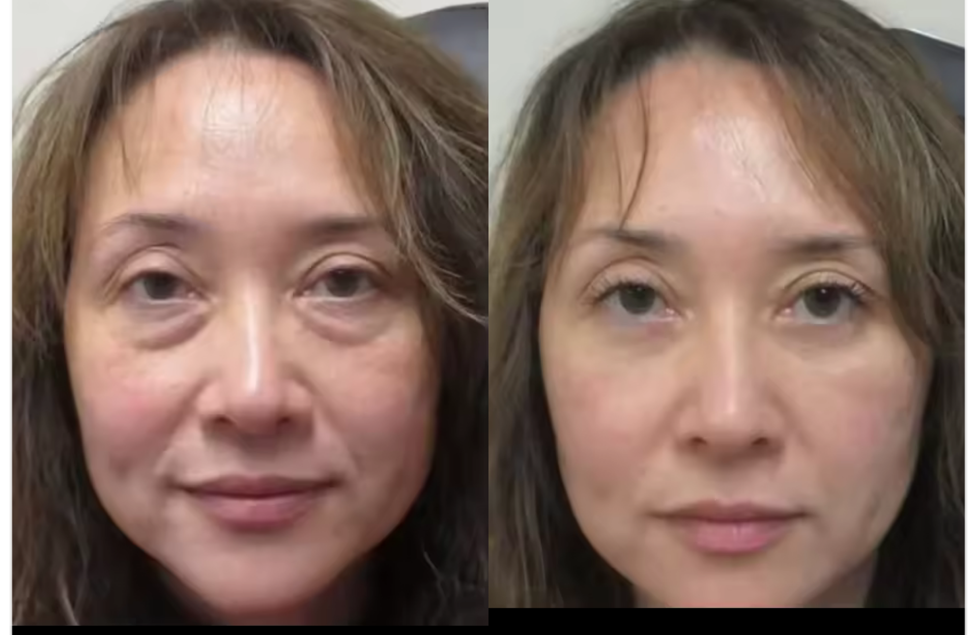 STAYVE - SÉRUM HYALURONIC ACID +++