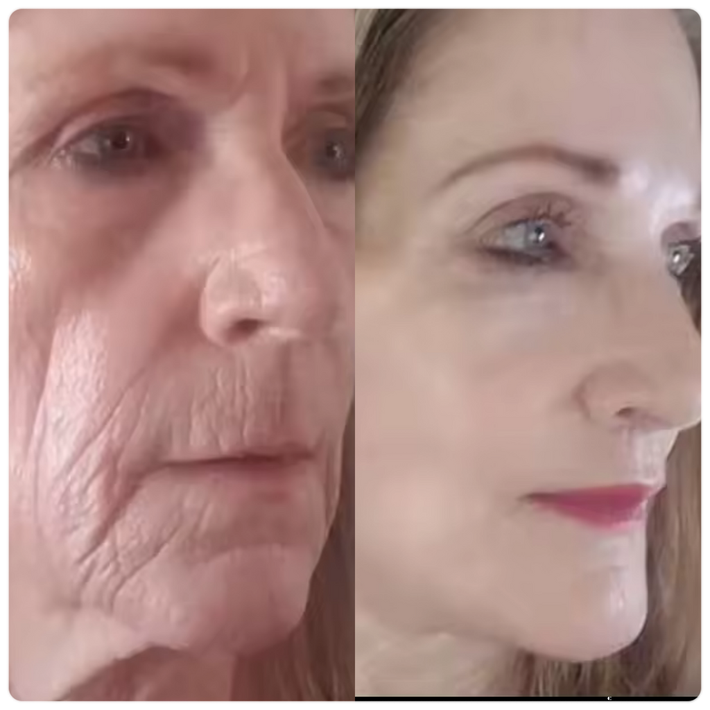 STAYVE - SÉRUM HYALURONIC ACID +++