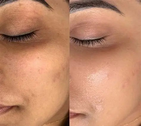 STAYVE - SÉRUM TEINTÉE N°3 - BB GLOW