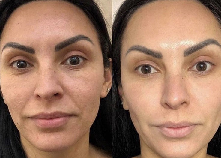 STAYVE - SÉRUM TEINTÉE N°2 - BB GLOW