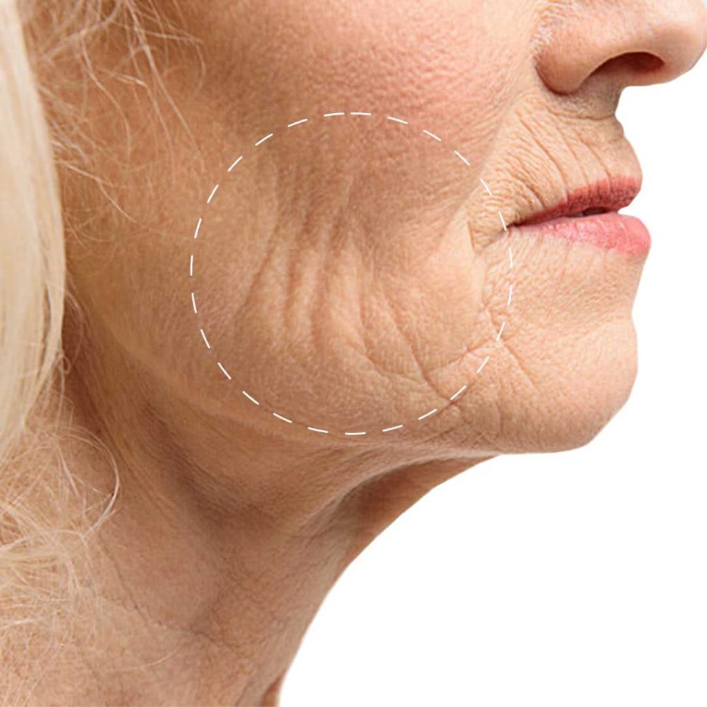 STAYVE - SÉRUM COLLAGEN