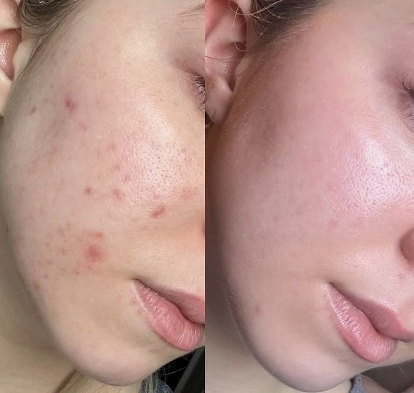 STAYVE - SÉRUM COLLAGEN