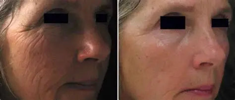 STAYVE - SÉRUM COLLAGEN