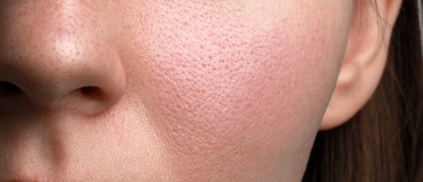 STAYVE - SÉRUM PEPTIDE GOLD