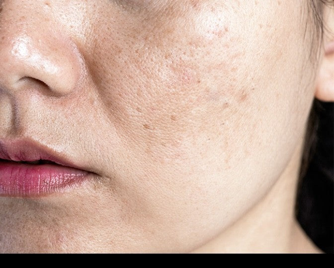 STAYVE - SÉRUM PEPTIDE GOLD