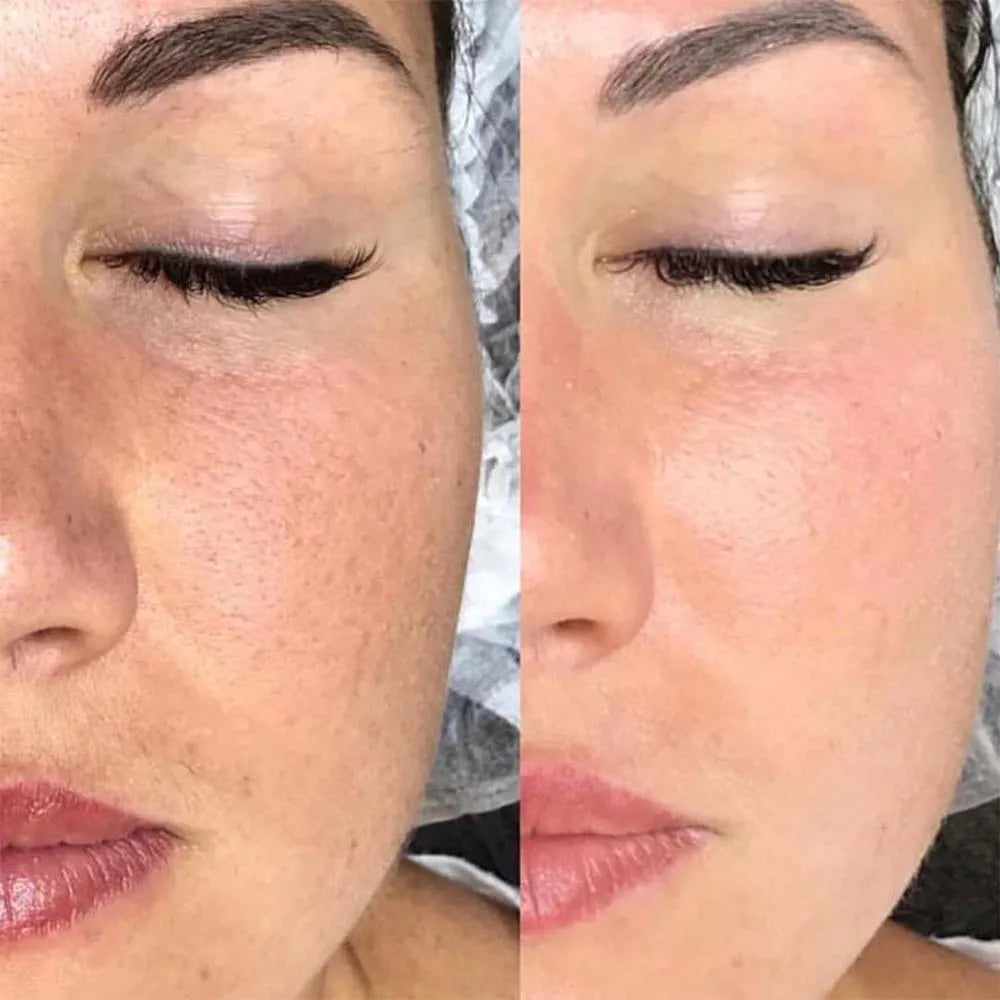 STAYVE - SÉRUM TEINTÉE BLUSH - BB GLOW