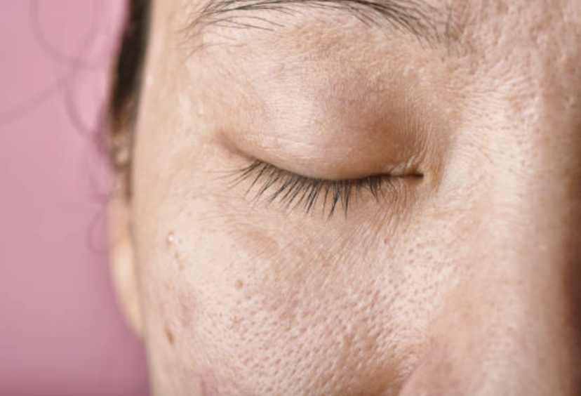 STAYVE - SÉRUM SALMON