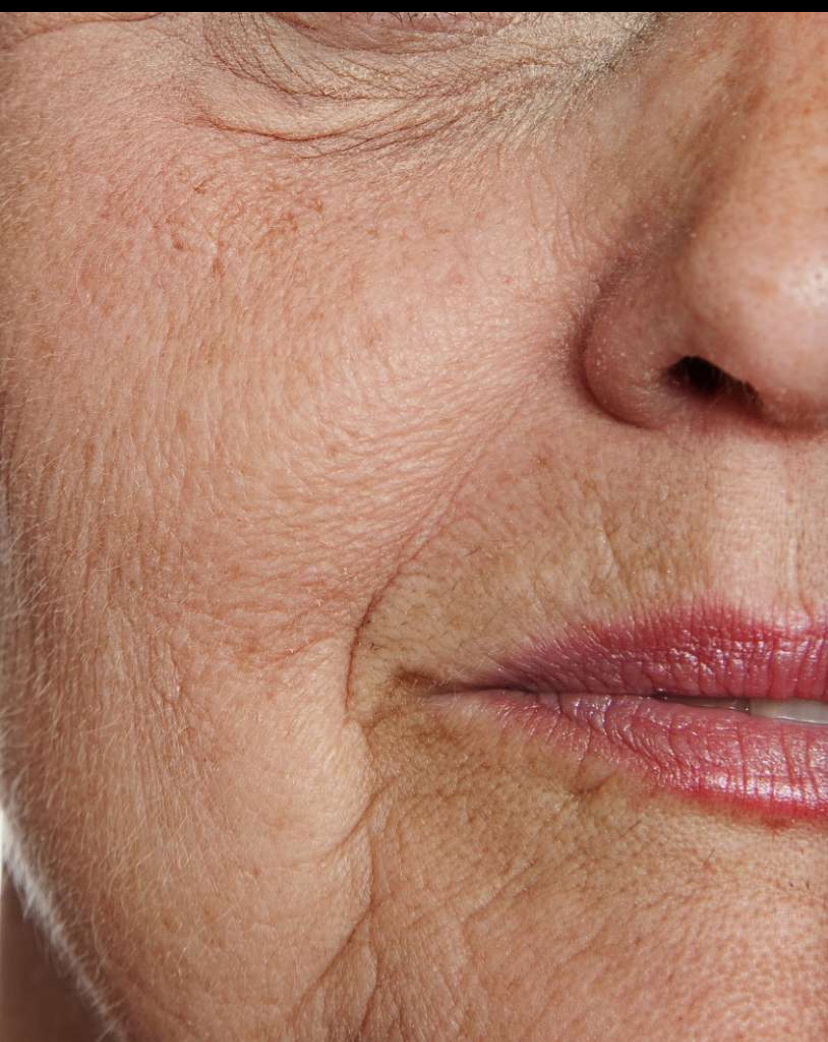 STAYVE - SÉRUM SALMON