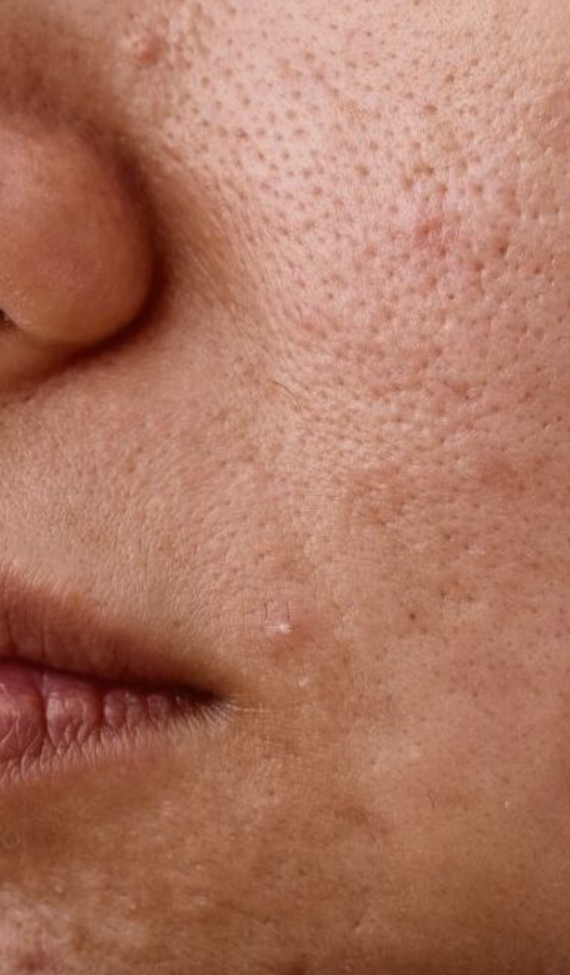 STAYVE - SÉRUM SALMON