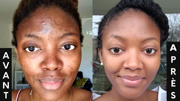 STAYVE - SÉRUM WHITENING